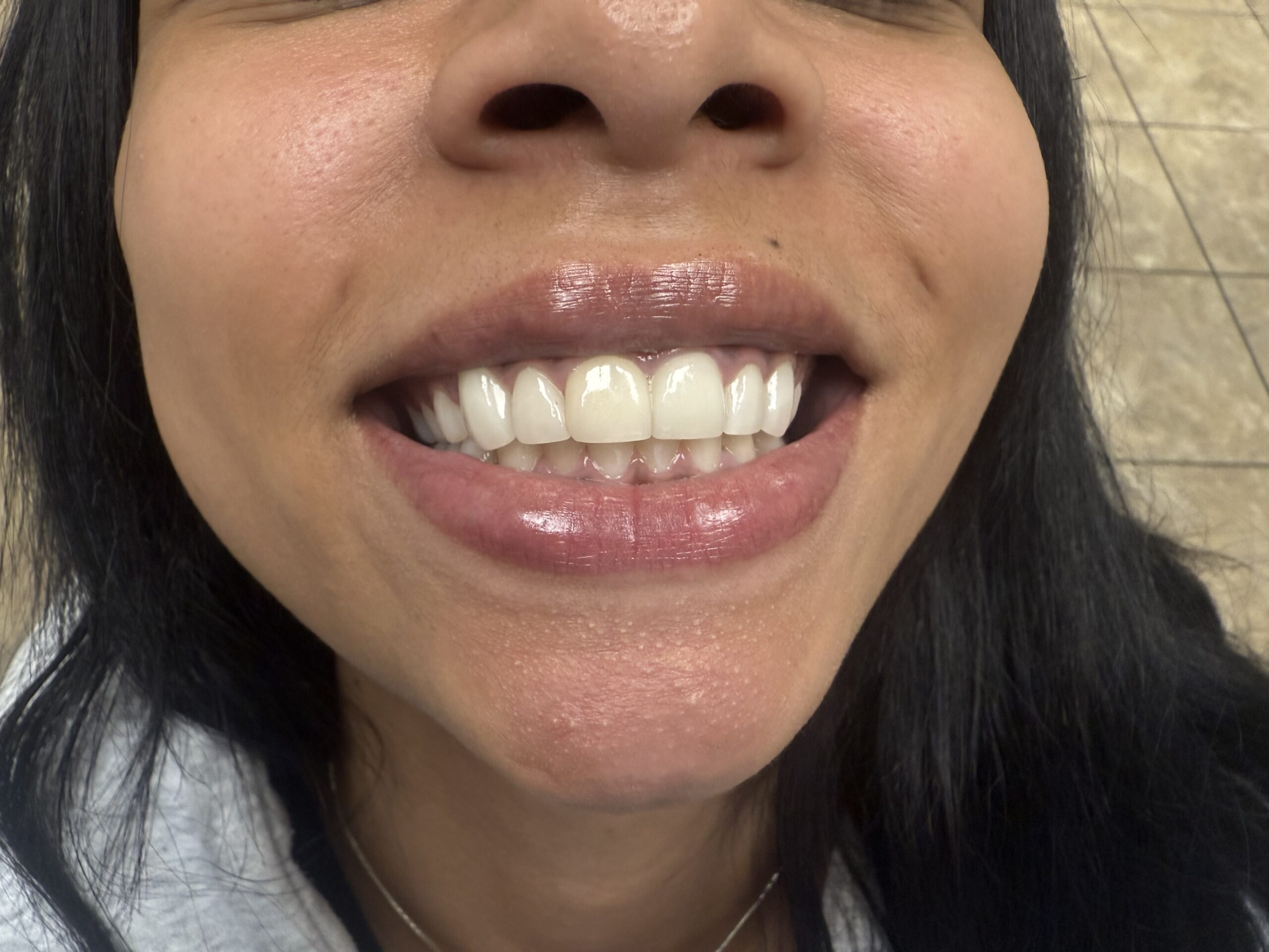 Comfortable dental care experience at Steele Creek Smiles Charlotte NC