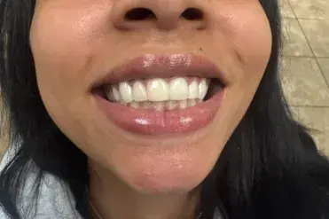 Happy dental patient