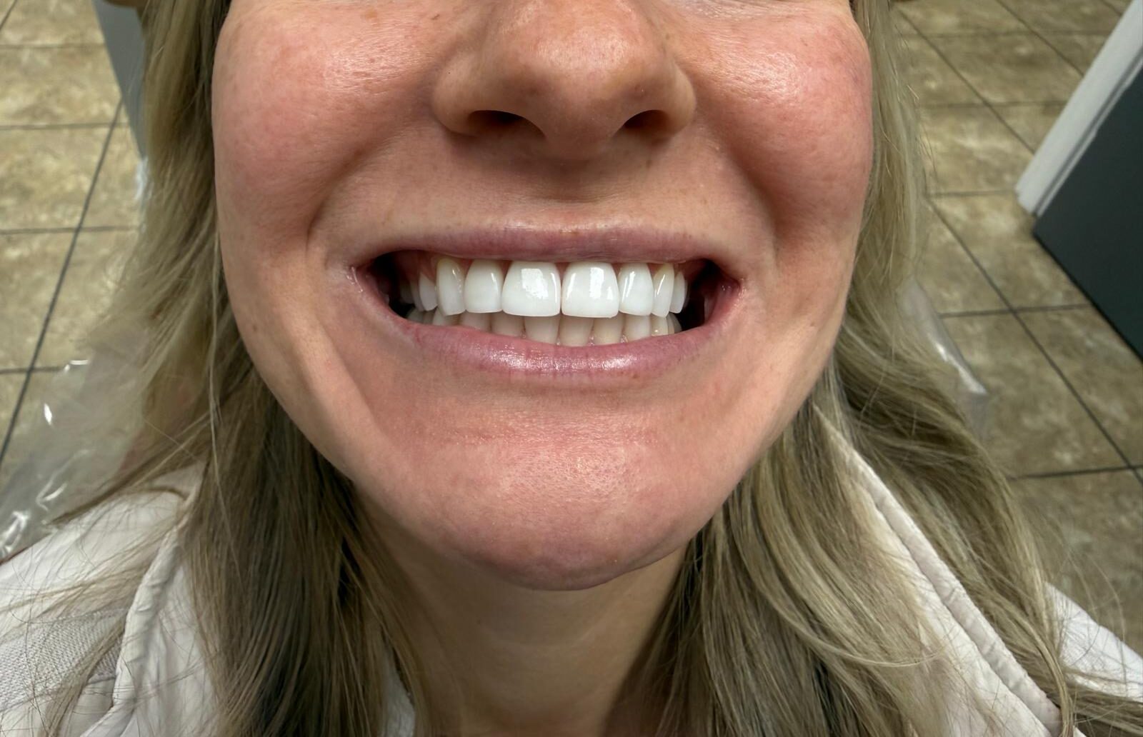 Modern dental clinic interior at Steele Creek Smiles in Steele Creek Charlotte