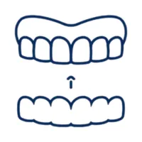 Clear Aligner