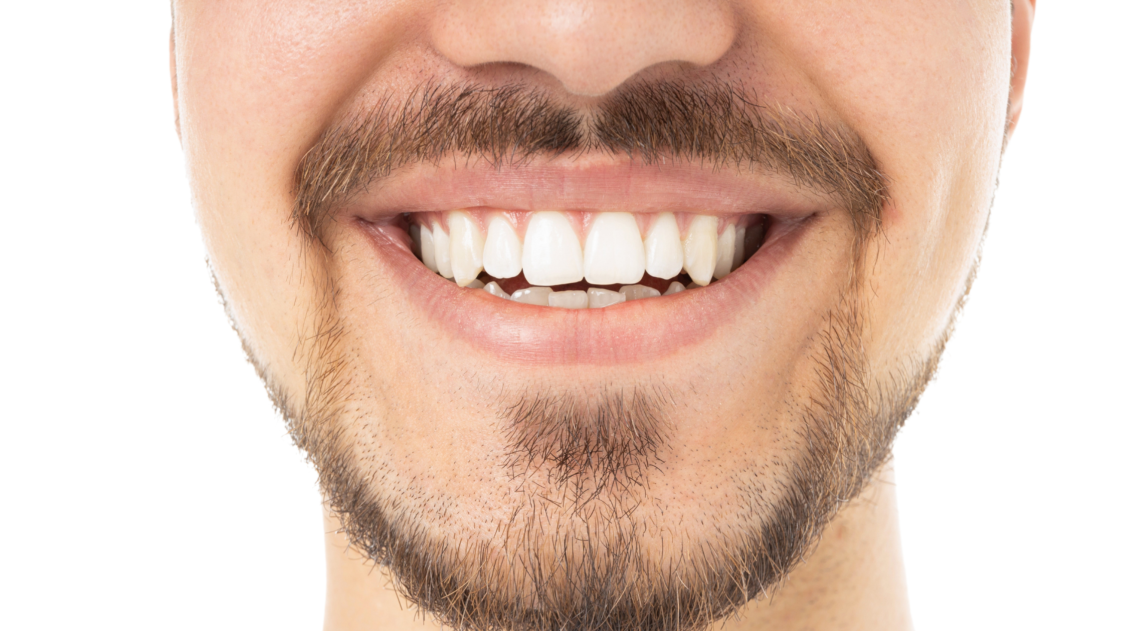 Discolored Teeth That Won't Whiten: What Are Your Options?
